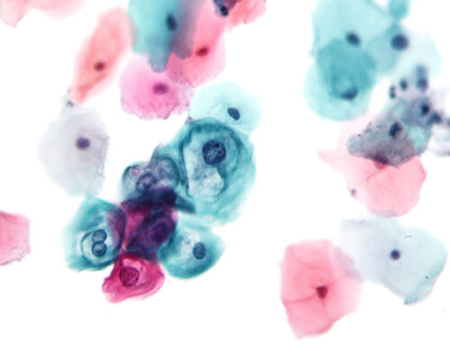 Pap Stain the Science Behind Your Pap Smear