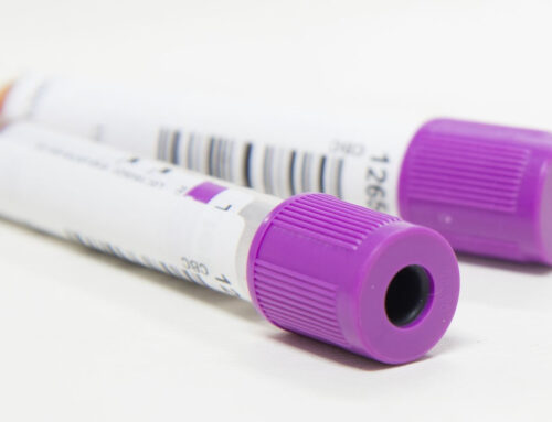 Biomarkers Used in Diagnosing Prostate Cancer